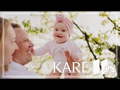 What to know about cleft lip, cleft palate