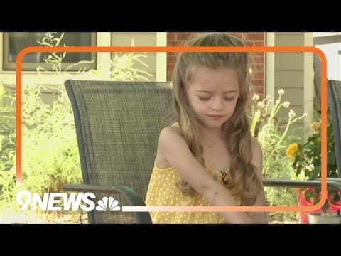 6-year-old girl recovering after dog attack in Fort Collins
