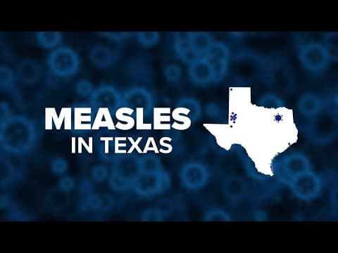 North Texas doctor explains how to keep your family safe from measles