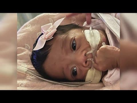 Miracle Babies | San Diego non-profit helps parents and hospitalized babies