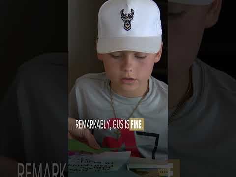 The parents and doctor of a boy who survived an arrow in his brain call his recovery "a miracle."