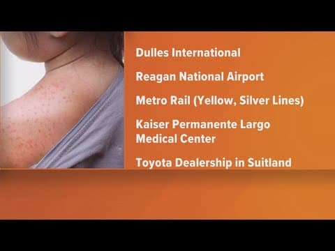 Health Alert | 2 new cases of measles reported in Prince George's Co.