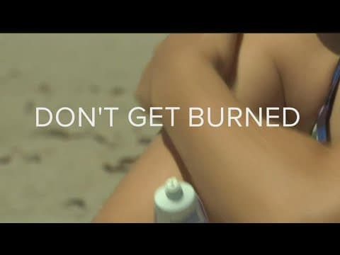 TIPS: How to avoid and soothe sunburns