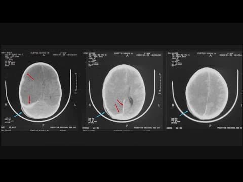 State officials push for Robert Roberson to be executed