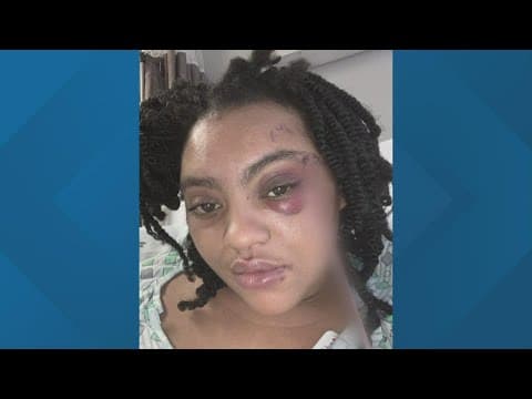 Woman who was shot while sitting at Columbus stop light thankful to be alive