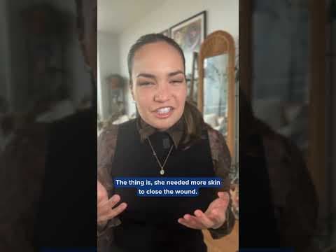 Fish skin saves bald eagle's life