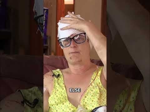 'They tried to eat me alive!' | Texas mother survives after brutal dogs rip apart her scalp, body