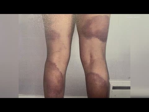 IMPD officers charged with battery, official misconduct wait for jury's decision