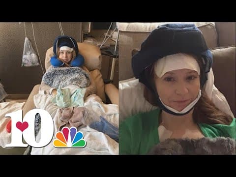 Buddy Check 10: Breast cancer survivor uses 'cold capping' to keep her hair