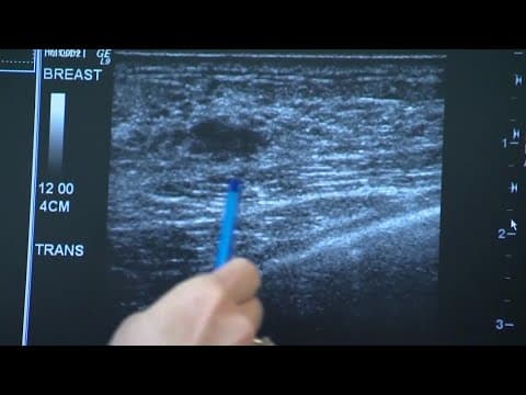 Breast Cancer Awareness Month: The relevance of mammograms