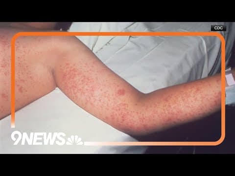 How to protect young children from measles