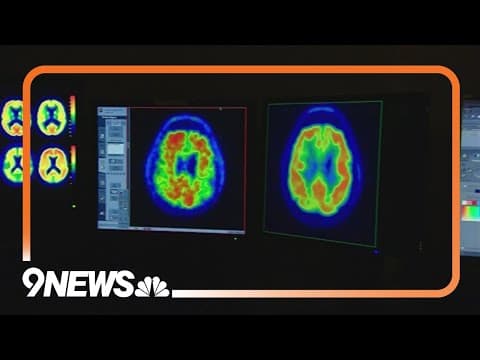 June is Alzheimer's Awareness Month