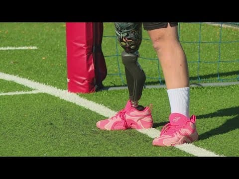 Fundraiser at Children's Museum of Indianapolis raises money for kids with limb loss