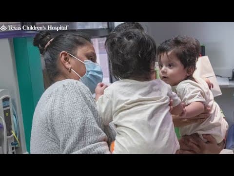 Formerly conjoined twin boys thriving a year after surgery to separate them at Texas Children's