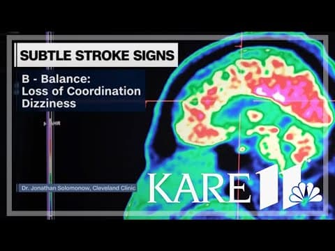 Know the subtle signs of strokes