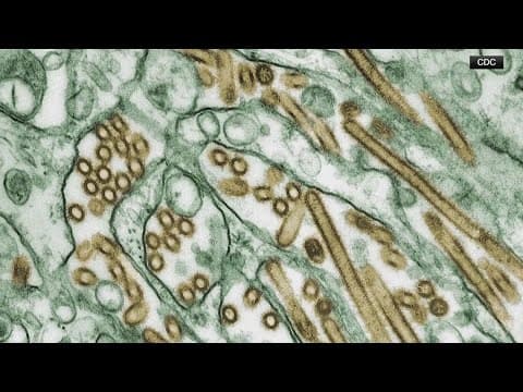 CDC confirms 1st US human bird flu case in America