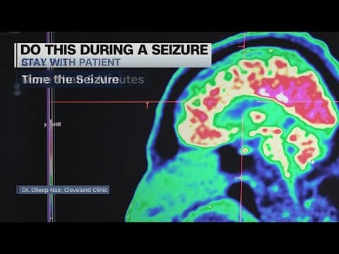 Here's what to do if you see someone experiencing an epileptic seizure