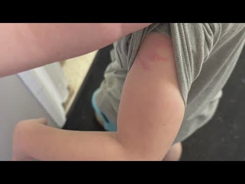 Mother accuses Columbus day care employee of abusing son