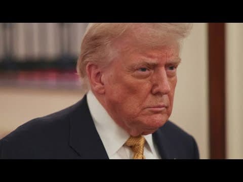 Trump diagnosed with vein condition