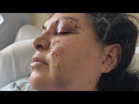 Texas detention officer attacked by teens shares unexpected words from ICU