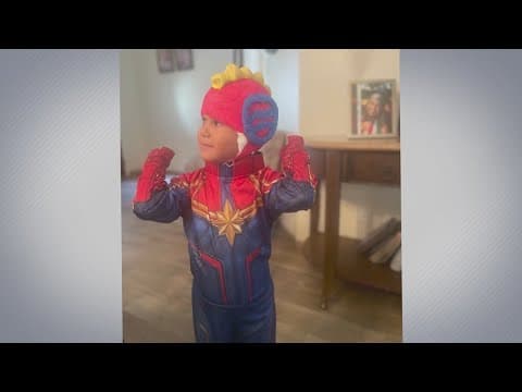 See how kids with skull and facial trauma turn into superheroes
