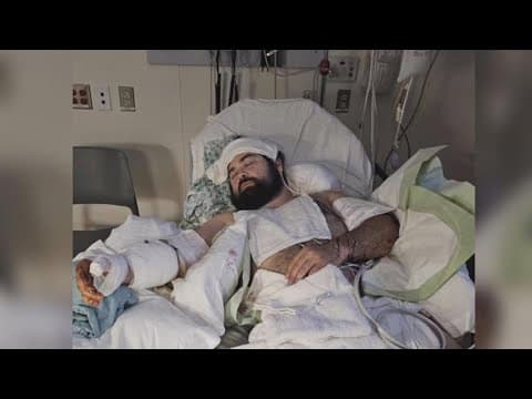 Survivor in Franklinton dog attack calls for owners to be held accountable