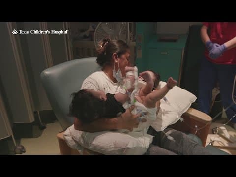 Formerly conjoined twin boys doing well after separation surgery at TCH in Houston