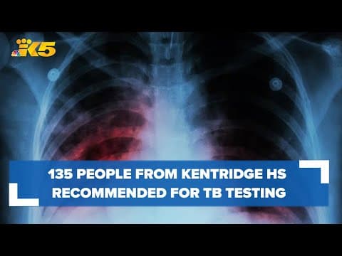 135 people from Kentridge High School recommended for tuberculosis testing