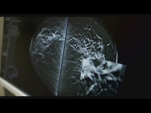 MedStar Georgetown talks breast cancer awareness after actor Olivia Munn's double mastectomy