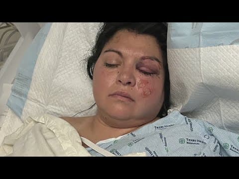 North Texas detention officer severely injured by juveniles escaping custody