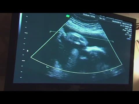 Judge blocks Ohio's abortion ban on hold for 14 days