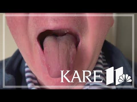 What your tongue says about your health