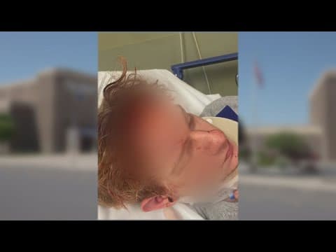 Central Indiana students worried after student attacked