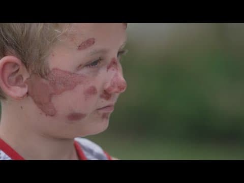 Fort Worth police search for SUV driver who hit an 8-year-old boy and ran