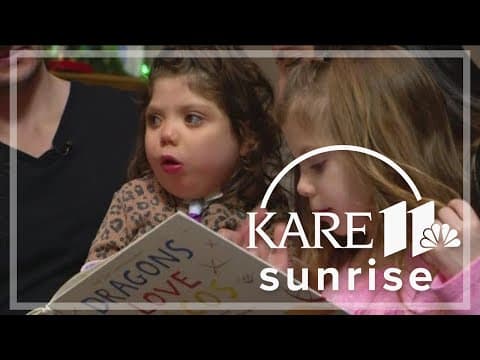 Parents of conjoined twins search for a nurse amid shortage