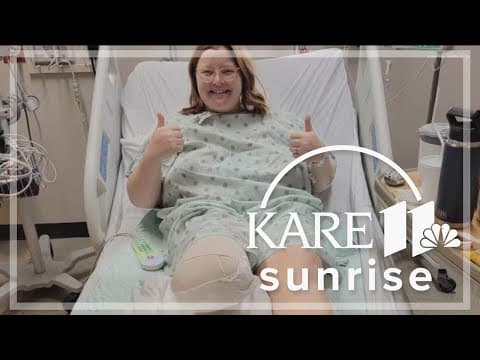 Kasson woman goes viral for her story of removing her foot and becoming an amputee